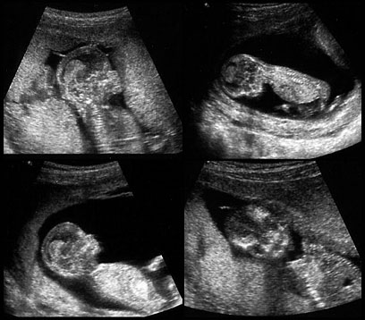 05-02-ultrasound-all